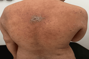 Health news thumbnail