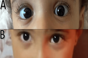 similar news thumbnail